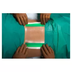 Folia chirurgiczna samoprzylepna Nobafilm®, 30 x 16 cm, 20 szt.